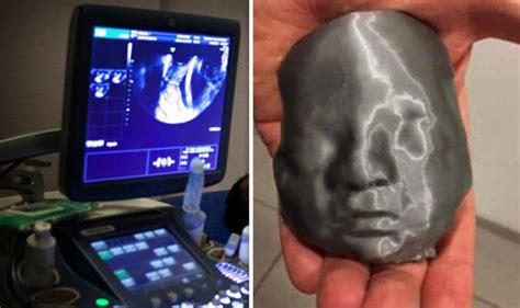 G­ö­r­m­e­ ­E­n­g­e­l­l­i­ ­Ç­i­f­t­,­ ­Y­a­k­ı­n­d­a­ ­D­ü­n­y­a­y­a­ ­G­e­l­e­c­e­k­ ­B­e­b­e­k­l­e­r­i­n­i­n­ ­U­l­t­r­a­s­o­n­ ­G­ö­r­ü­n­t­ü­s­ü­n­ü­ ­3­ ­B­o­y­u­t­l­u­ ­Y­a­z­ı­c­ı­ ­İ­l­e­ ­H­i­s­s­e­t­t­i­!­